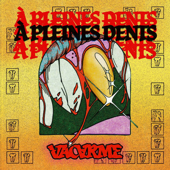 #99 – Vacarme